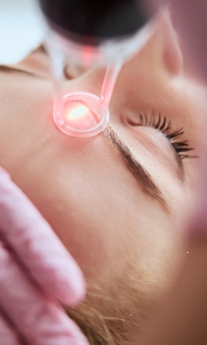 sun damage laser treatment