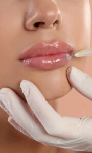 how long do lip fillers last