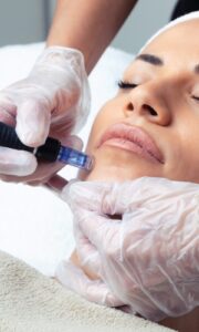 benefits of microneedling